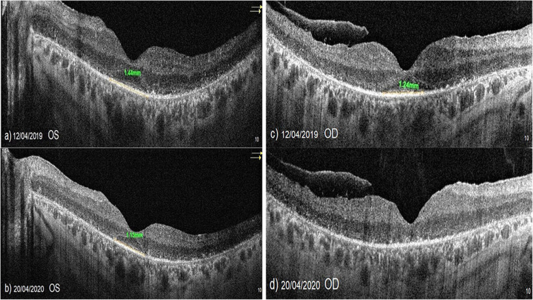 Fig. 7