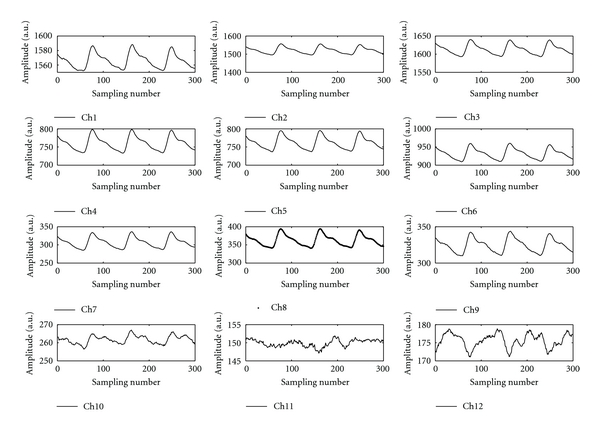 Figure 11