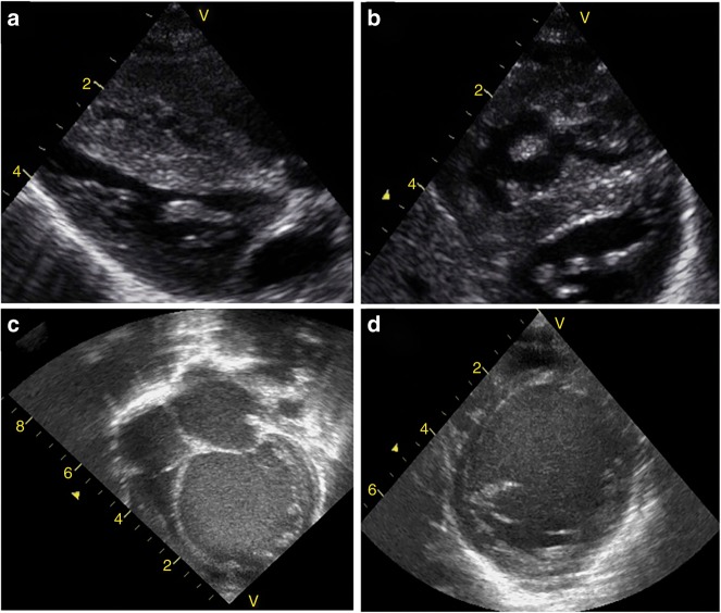 Fig. 2