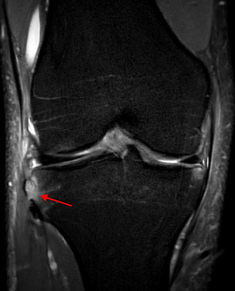 Fig. 11