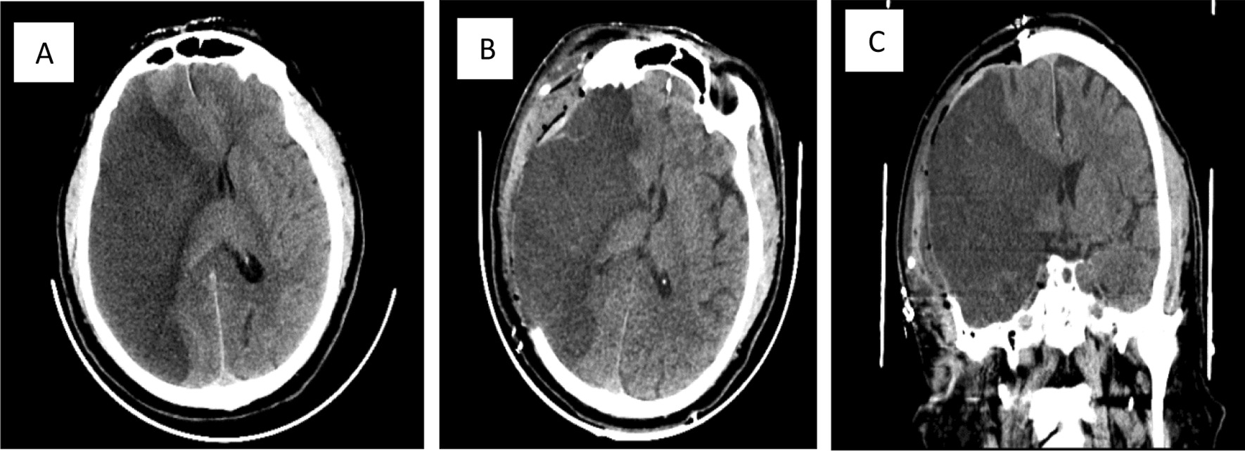 Fig.1