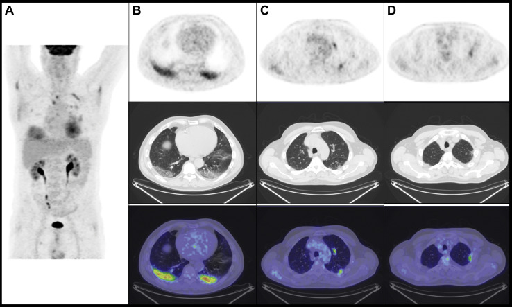 Figure 1