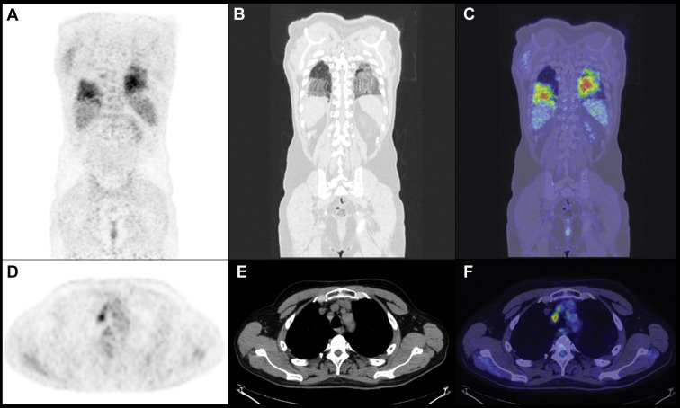 Figure 2