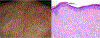 Fig 2.