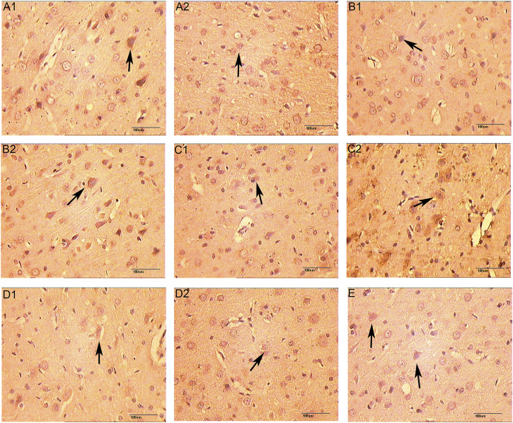 FIGURE 14