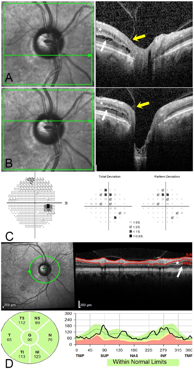 Fig 3