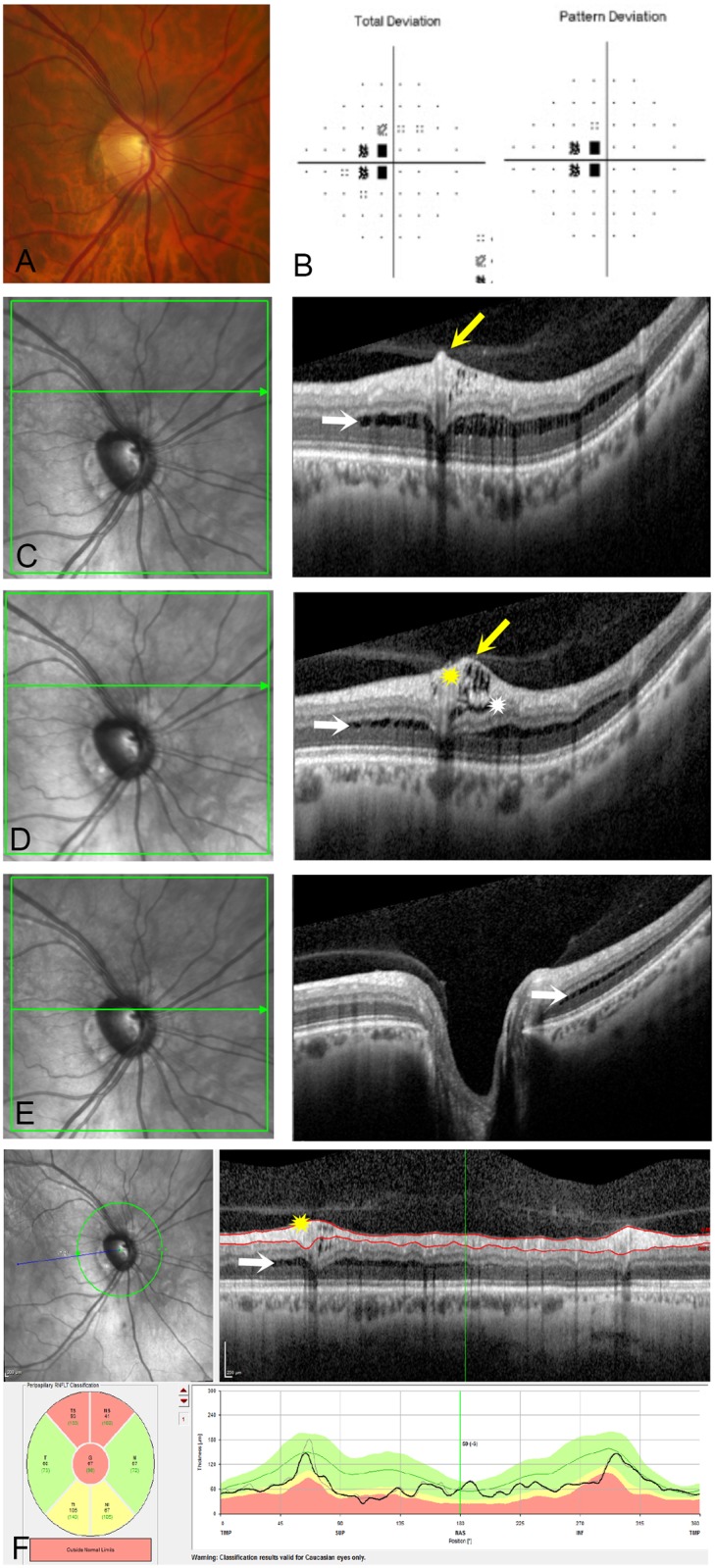 Fig 1