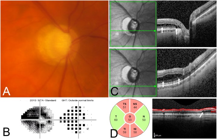 Fig 2