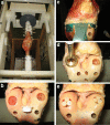 Fig. 2