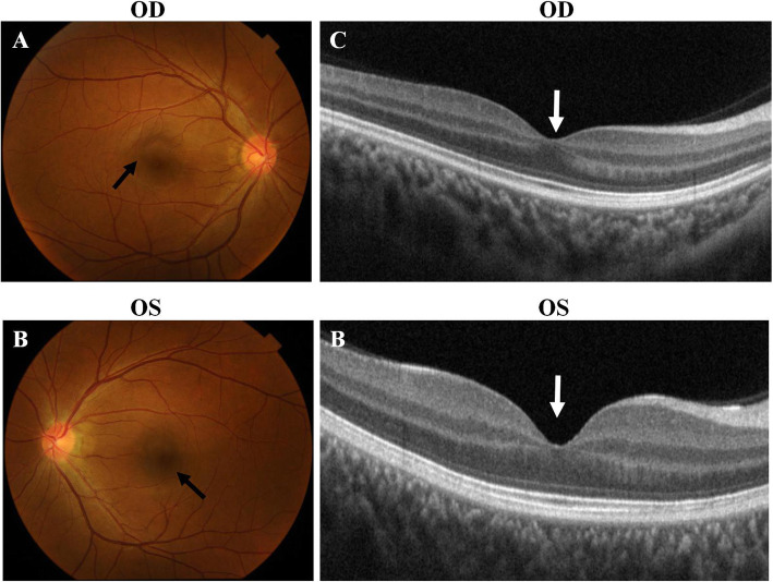 Fig. 4