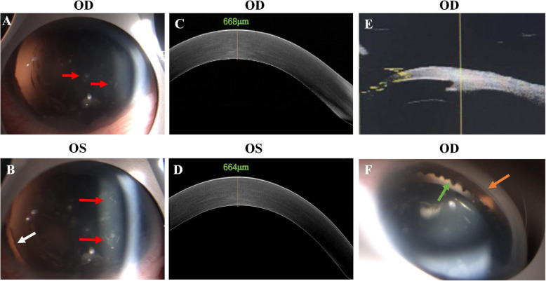 Fig. 2