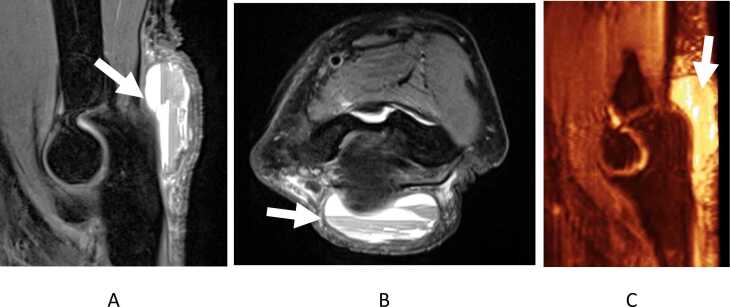 Fig. 10