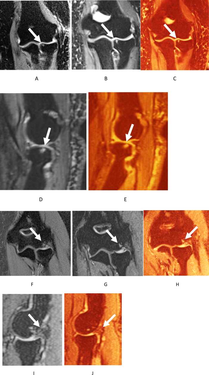 Fig. 15