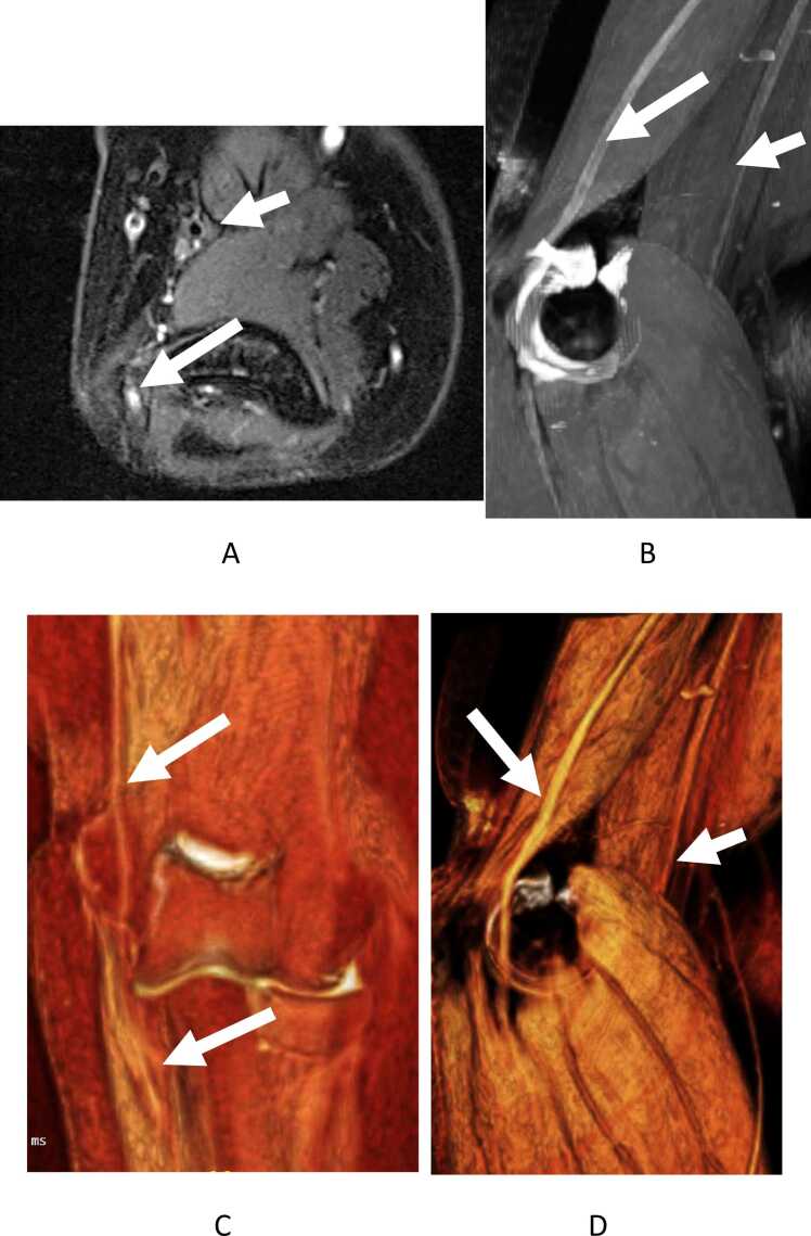 Fig. 13