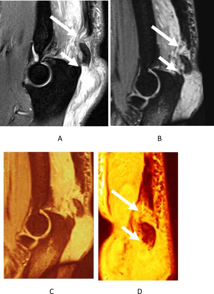 Fig. 9