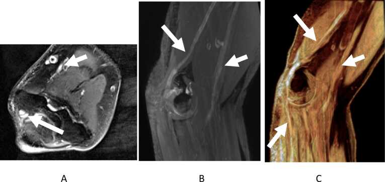 Fig. 14