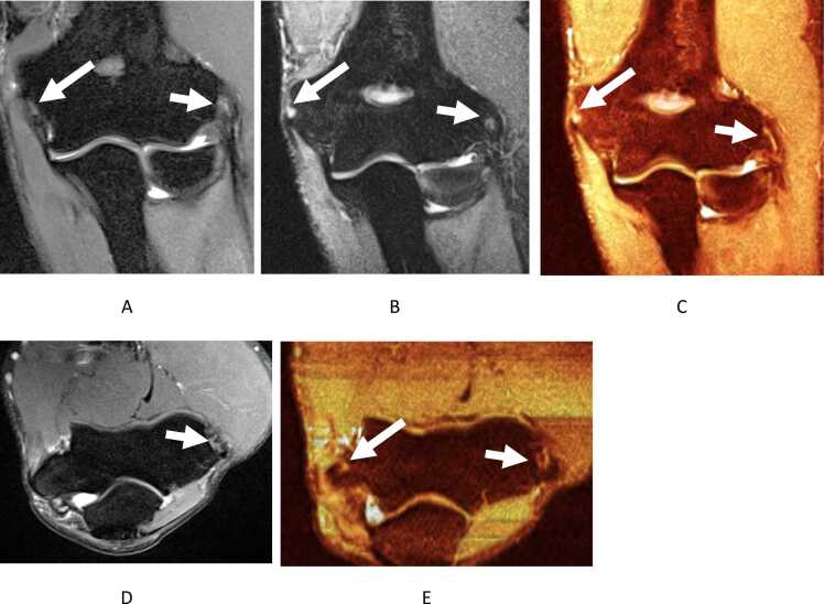 Fig. 5