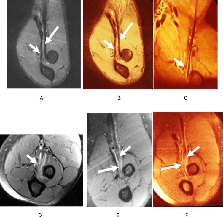 Fig. 11