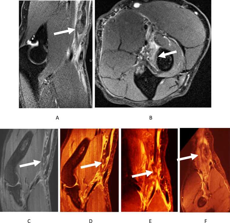 Fig. 12