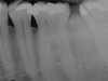 Fig. 12