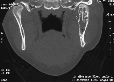 Fig. 7