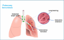 Fig. (3)