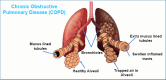 Fig. (5)