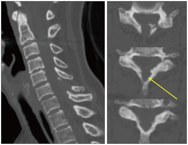 Fig. 1