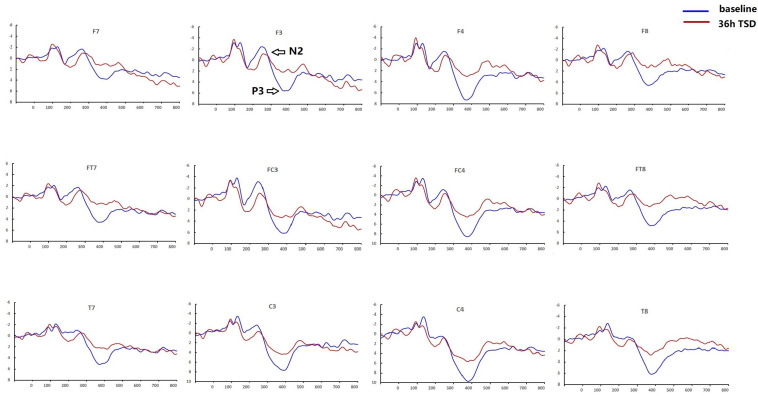 FIGURE 3