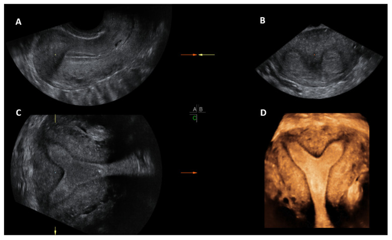 Figure 6