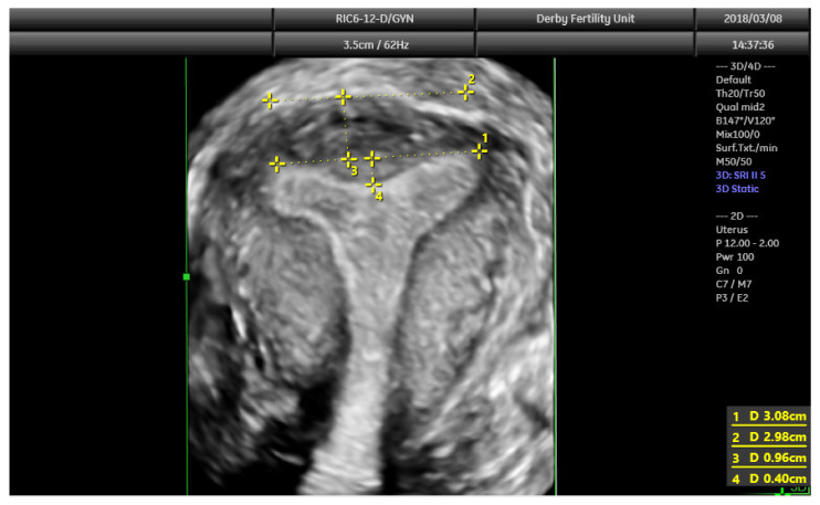 Figure 9