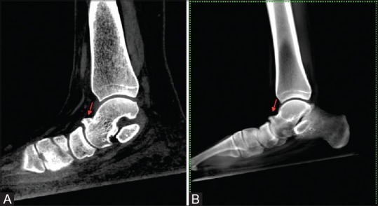 Figure 15 (A and B)