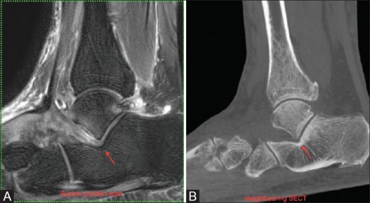 Figure 13 (A and B)