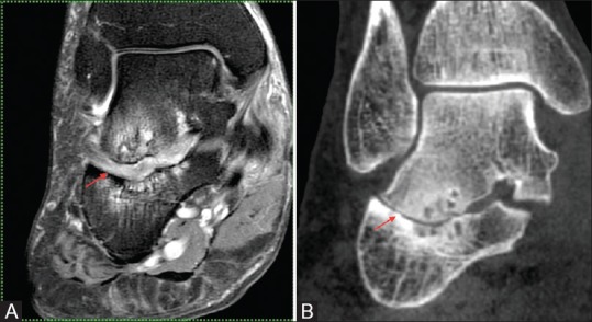 Figure 11 (A and B)