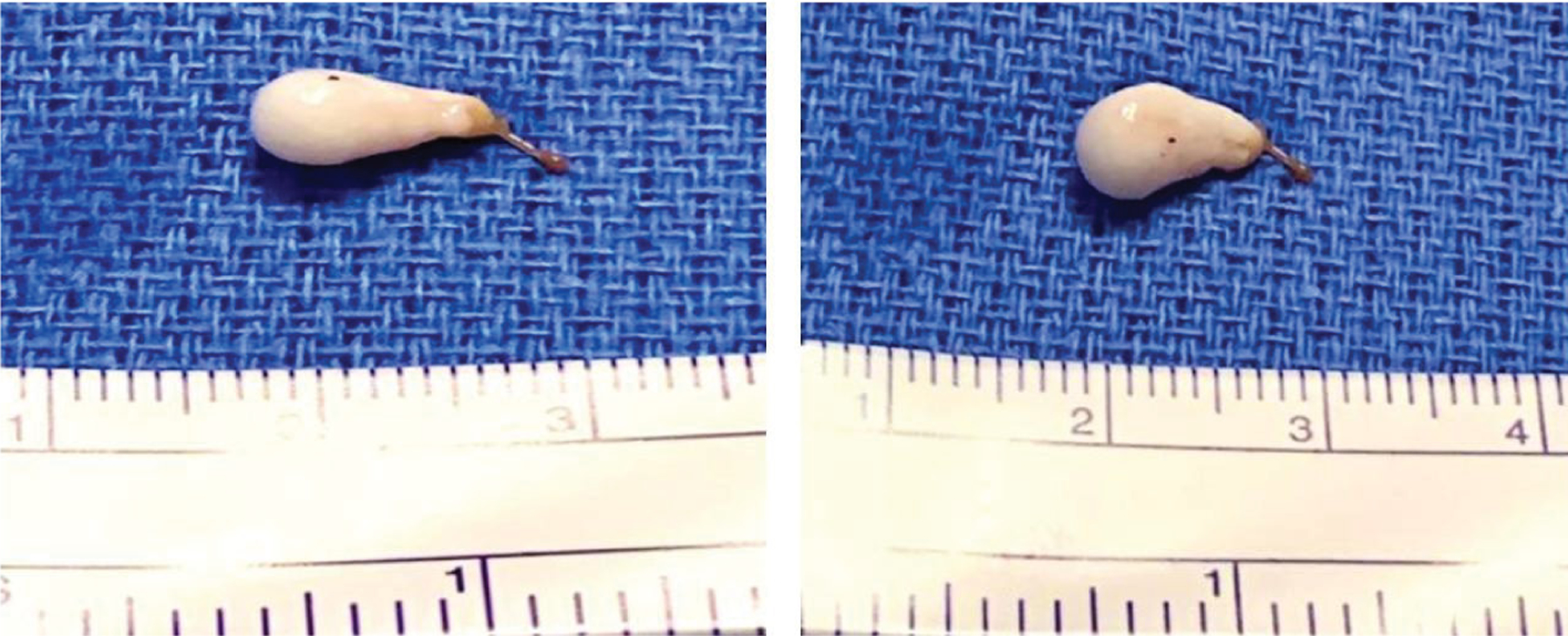 Figure 2: