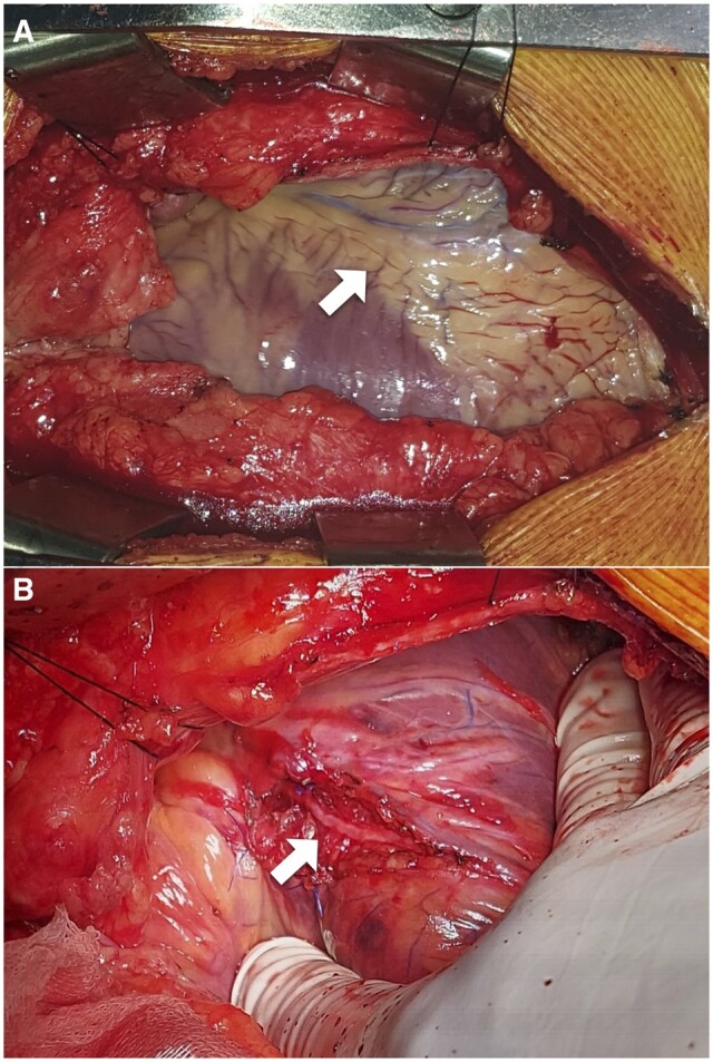 Figure 3: