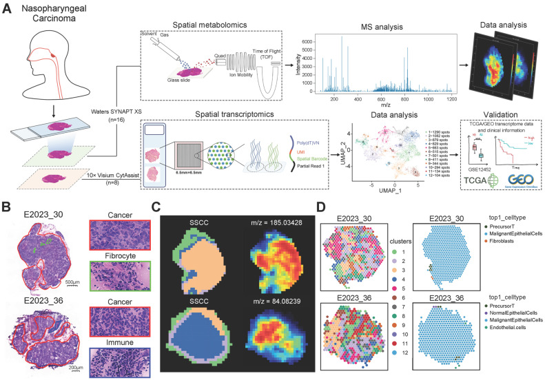 Spatial Metabolomics and Transcriptomics Reveal Metabolic Reprogramming ...