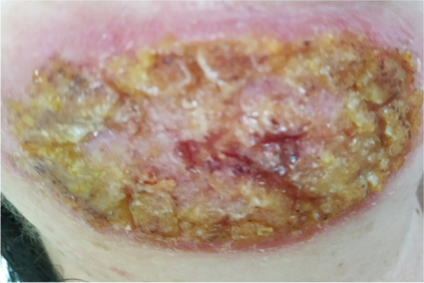 Fig. 2.