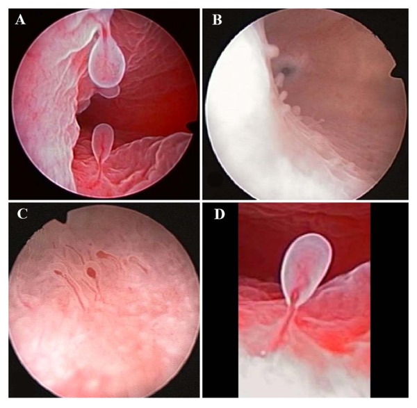 Fig 2