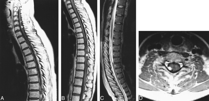 fig 3.