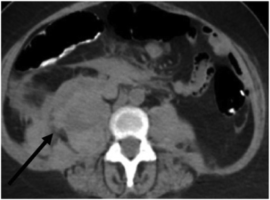 Fig. 5