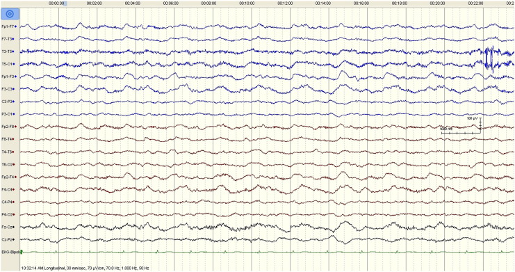 Fig. 1