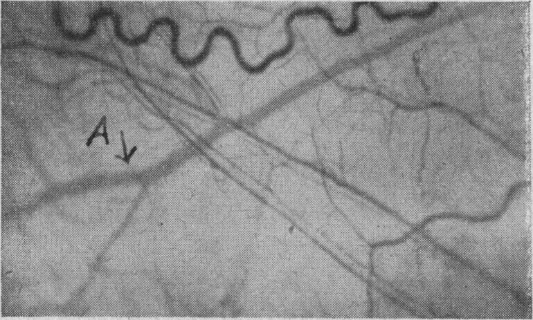 Fig. 10