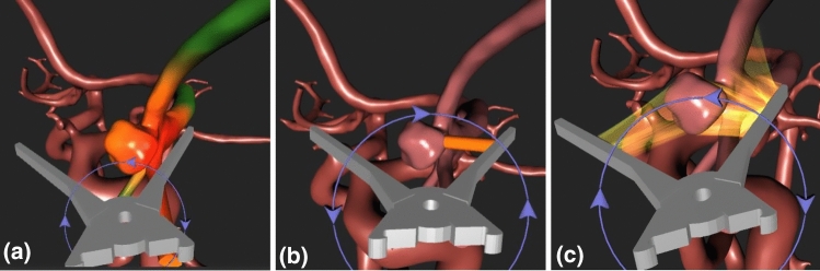 Fig. 2