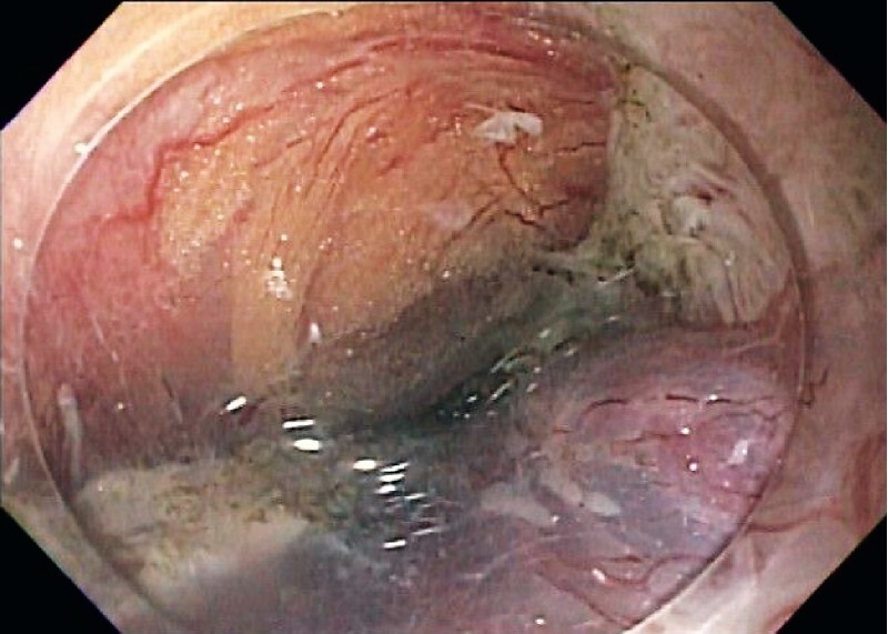 Fig. 3