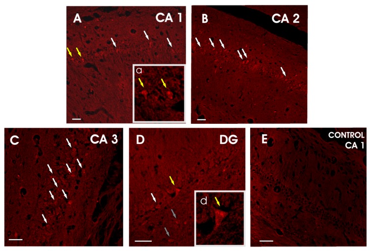 Figure 14