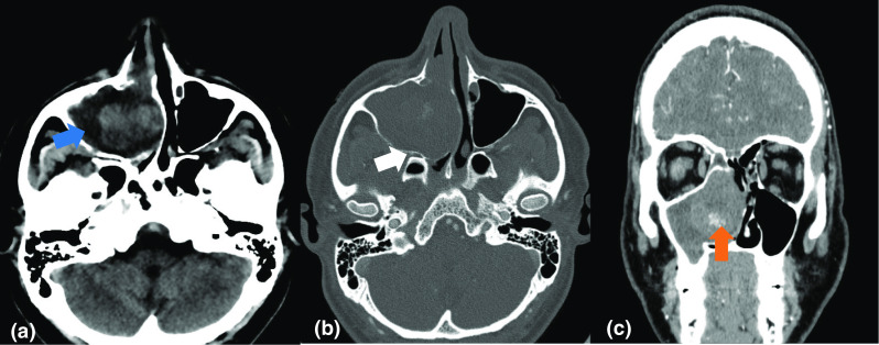 Fig. 1