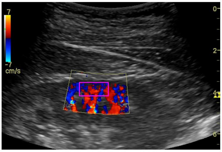 Figure 5