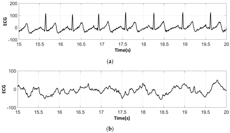 Figure 18