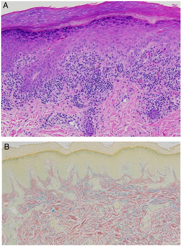 Figure 2